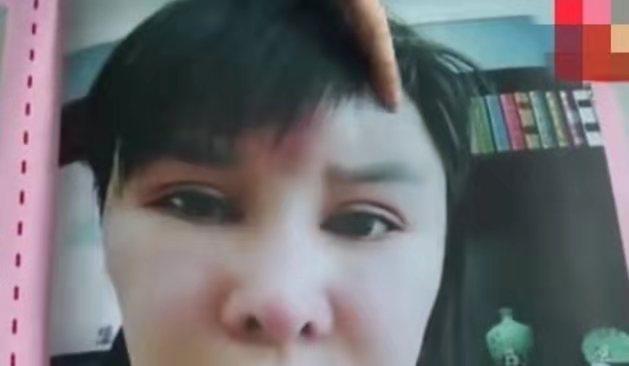 女子花30萬整容失敗，丑到丈夫不敢看，看到整前照片網(wǎng)友不淡定了