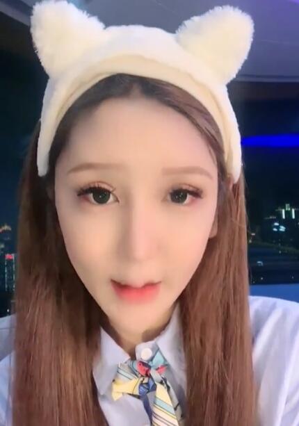 女網(wǎng)紅出現(xiàn)整容后遺癥被罵怪物，眼睛瘋狂抽搐，卻口口聲聲說整容沒失敗