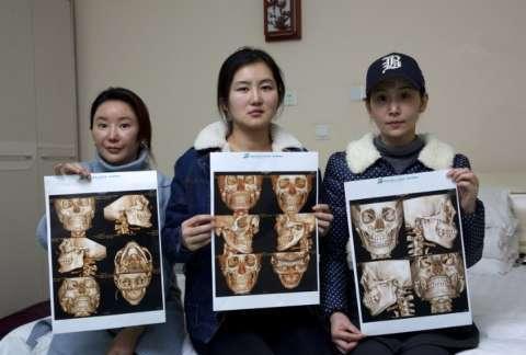 直擊整容失敗的女孩，看了之后你還想整容嗎？