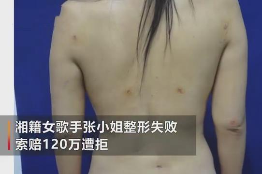 歌手張美美抽脂失敗，要求醫(yī)院賠償一百二十萬，副總監(jiān)：人又沒死