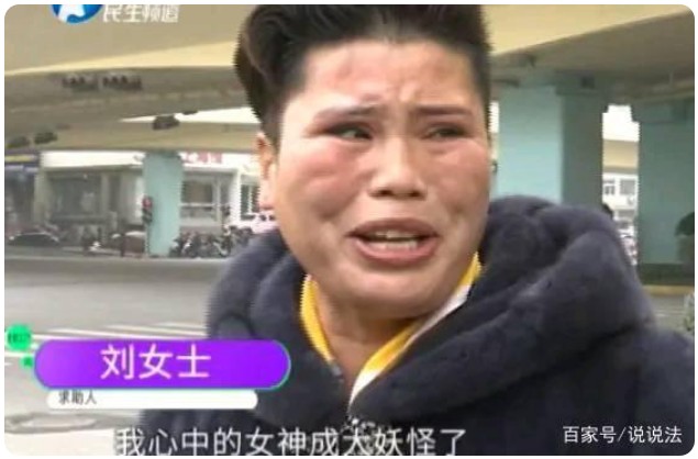 鄭州女子整容失敗崩潰：以前萬人迷，現(xiàn)在像妖怪：談?wù)莘删葷?jì)
