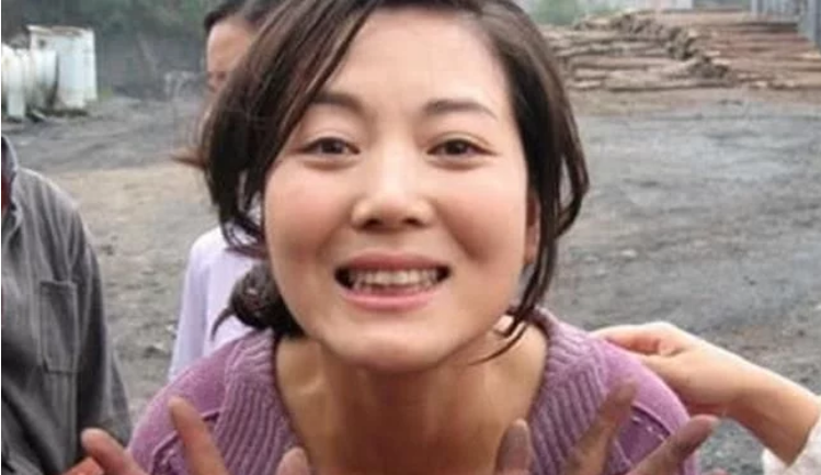 又一個(gè)整容失敗案例，曾因拍戲打掉孩子，今“整容”卻無人認(rèn)識!