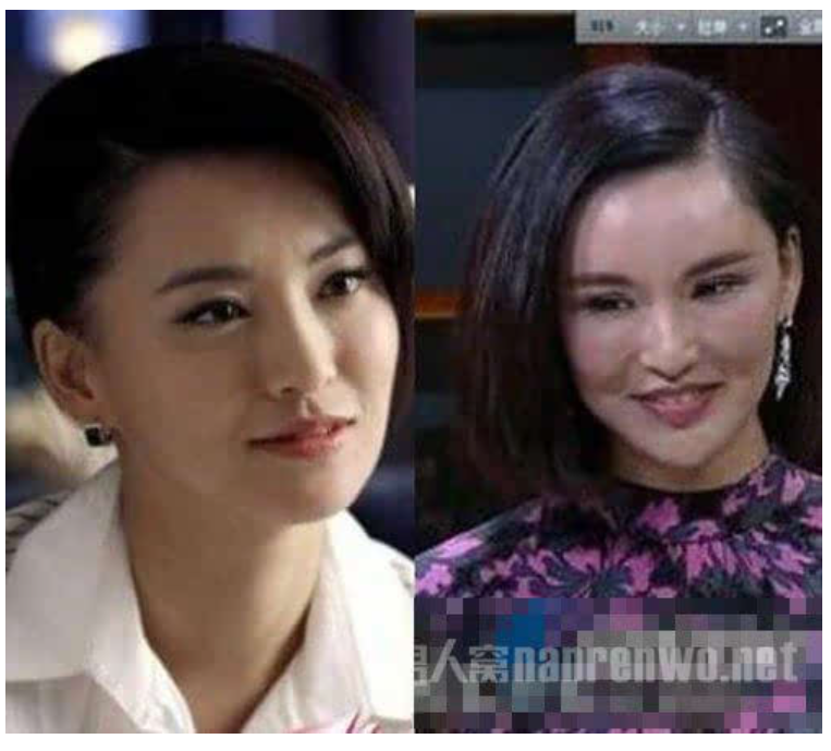 整容失敗的明星案例一覽 